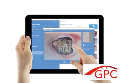 Wound Care App